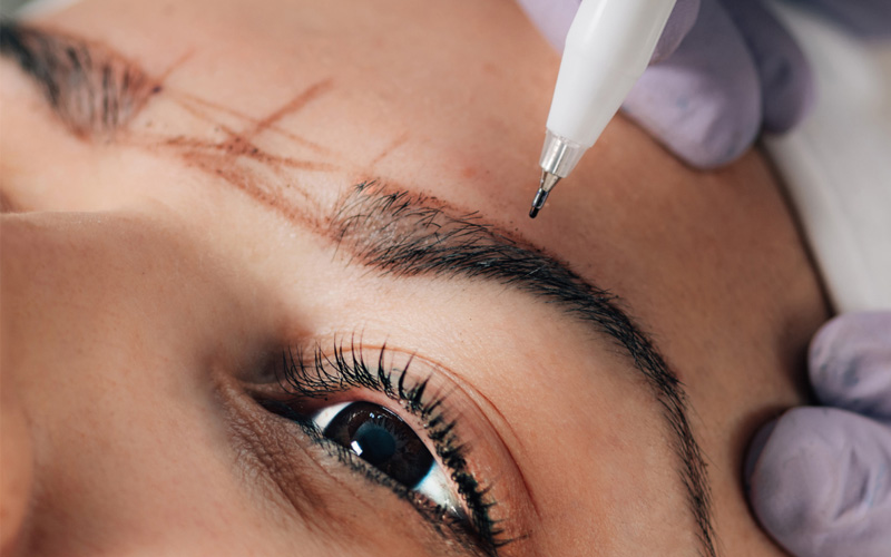 A-Comprehensive-overview-of-the-brow-lift-Melbourne-procedure